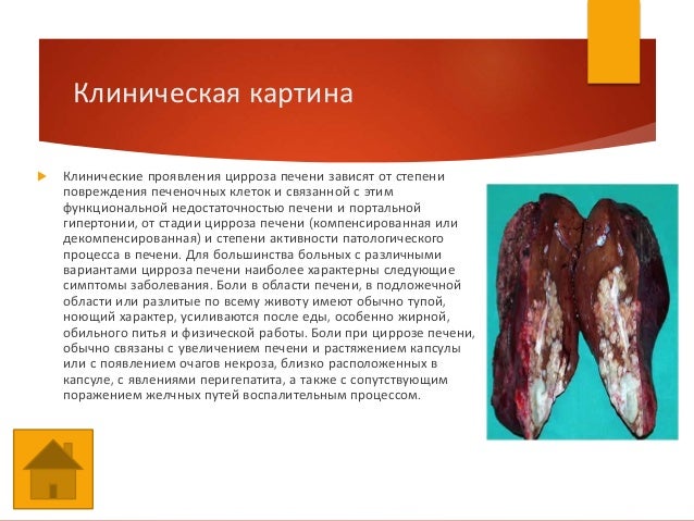 Купить декор для дома в Красноярске - интернет Кто и чем выводит папилломы в домашних условиях